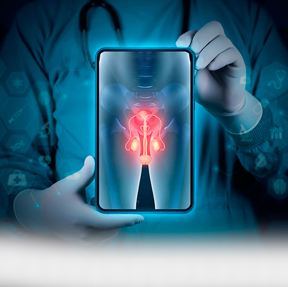 Diagnóstico de cáncer de próstata